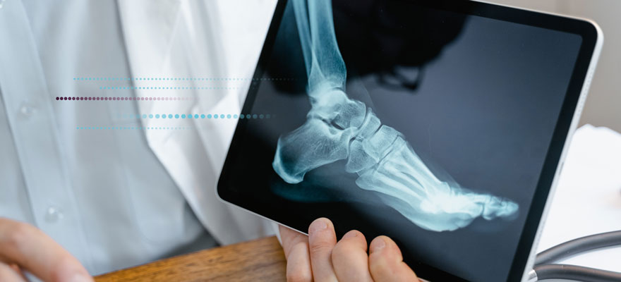 Radiografia de un pie